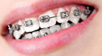 Clinica dentara Elveto Dent